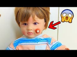 Reborn Boy Has BIG PIMPLE On Photo Day And Freaks OUT!
