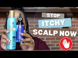 STOP ITCHY SCALP NOW With My Favorite Products!