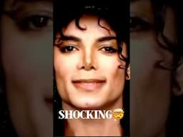 Mystical Michael Jackson & Survival🤯🙈 #psoriasis