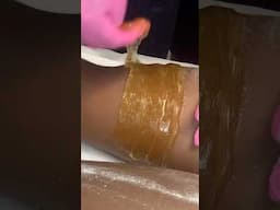 SUGARING | SUGAR WAX #waxing #sugarwaxing #sugaring #hairremoval #waxinglegs #brazilianwaxing