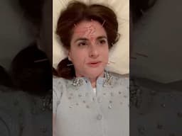 Come with me to put needles in my face