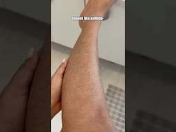 😳OMG Burnt My Skin In Goa Happened In GOA #shorts #ytshorts #Ashortaday