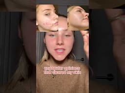 controversial opinions that CLEARED MY SKIN!🫣