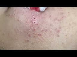 Linhmydangspa ( 21/4/2025) p1
