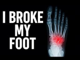 🎥 I BROKE MY FOOT – 4th Metatarsal Fracture (Left Foot) | Injury Story, Symptoms, and Recovery Plan