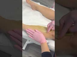 SUGARING | SUGAR WAX #waxing #sugarwaxing #sugaring #hairremoval