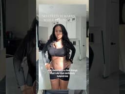 How I Avoided Stretch Marks while Pregnant! 5week postpartum