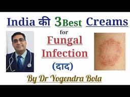 Fungal Infection - ko theek karne ke best creams   # Dr Yogendra Bola