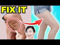 Losing Cellulite & Tightening Flabby Thighs — Even in Menopause