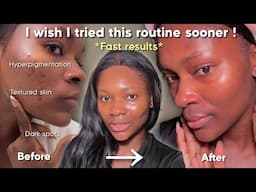 HOW TO CLEAR DARK SPOTS AND HYPERPIGMENTATION FAST | Simple and effective step by step routine