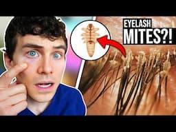 Do Microscopic Mites Live in Your Eyelashes RIGHT NOW?!