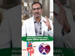 குழந்தைகளுக்கு ஏற்படும் ASD பிரச்சனைக்கு அறுவைசிகிச்சை தேவையா?| Heart Problems in Children