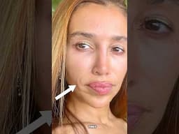 What Filler Buildup REALLY Looks Like  #filler