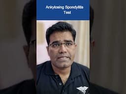 Ankylosing spondylitis की जाँच #ankylosingspondylitis