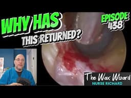 WHY HAS THIS RETURNED? Episode 428 (12 month update)