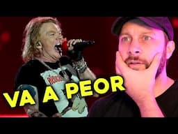 Lo de AXL ROSE ya clama al cielo.