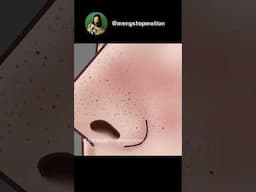 Oddly Satisfying ASMR Animation: Pimple Popping + Blackhead Removal ✨ Night Skincare Routine  #asmr