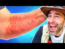 What DESTROYED my Arm? Caterpillar? Toxic Plant? Jungle Ants?