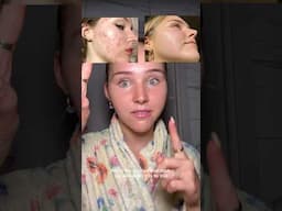 the routine that will CLEAR YOUR SKIN⭐️ (final part)