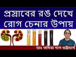 প্রস্রাবের রং বলে দেয় শরীরে কোন রোগ বাসা বেঁধেছে Urine Colour & Disease|| Dr.Tanima DasBhattacharya
