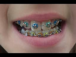 Brackets Paso a Paso - Ma01rp