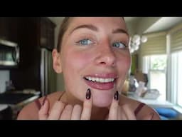 I got NEW TEETH! La vlog & disneyland