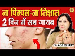 Acupressure Points For Pimples And Dark Spots