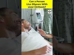 Can Liver Cirrhosis Patients REALLY Live 20 Years