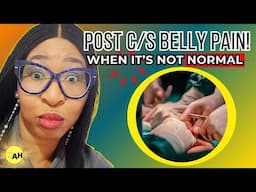 Is Your Post C-Section Pain Normal or Something Worse?