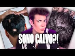 PERDO I CAPELLI ⚠️ LA MIA ESPERIENZA, CONSIGLI DAVVERO UTILI !!!