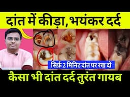 दांत दर्द तुरन्त आराम | सिर्फ 2 मिनट में कैसा भी दांत दर्द तुरन्त आराम मिल जाएगा | Toothache Remedy