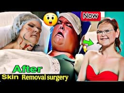 1000-Lb. Sisters’ Tammy Faces Her Fears, Gets Skin Removal Surgery: 'Seriously Freaking Terrified'