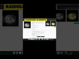 AI Agents for Radiologists. #healthcareai #ai #youtubeshorts #shorts #youtube #medicalai #aiagents