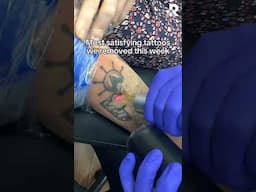 Satisfying tattoo removals😍 #removery #tattooremoval