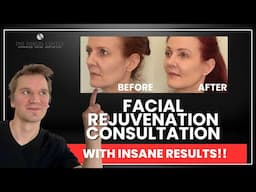Facial Rejuvenation Starts Here: Facial Plastic Surgeon Shares What to Expect at Your First Visit