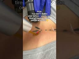 Goodbye tattoo, hello outfit freedom👋 #removery #tattooremoval