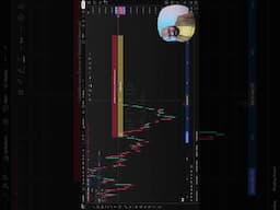 Trap On NIFTY - Be Careful #nifty #stockmarket