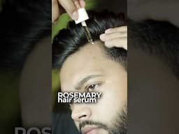 Fix Receding Hairline at Young Age😍 #recedinghairline #shorts