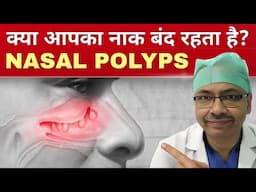 Nasal Polyps surgery | नाक का मांस बढ़ना | operation karaaye ya Nahi??