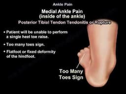 Ankle Pain Explained: Causes, Symptoms, and Treatment.