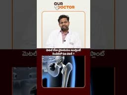 మెటల్ లేదా టైటానియం ఇంప్లాంట్ - ఏది మంచిది? #OurDoctorsForUs