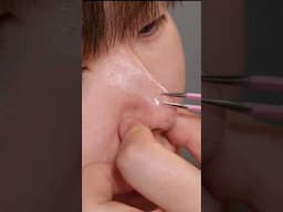 Blackhead removal Nose blackhead| Nose blackheadremoval Pore strips #skincare#viralvideo #shorts🔥