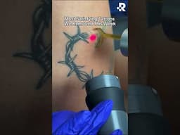Satisfying tattoo removals #removery #tattooremoval