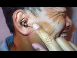 something big is stuck in his ear..