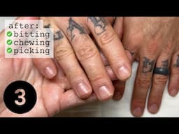 Check out this progress! Restart your nails.... after falling off the wagon [PART 3]