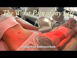 Living with Endometriosis and Chronic Illness in my 20's