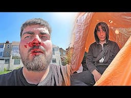 10 YEAR OLD HOMELESS BOY BROKE MY NOSE… (Police Called!)