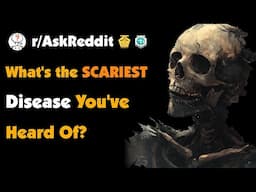 What's the Scariest Disease You've Heard Of?