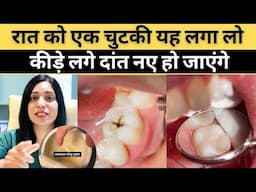 कीड़े लगे,खोखले दांतों को ठीक करने का बेस्ट तरीका | Best way to cure cavities and hollow teeth |