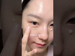 Retinal vs. dark circles